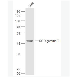 Anti-ROR gamma T antibody-C维甲酸相关孤儿受体γt抗体