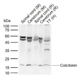 Anti-Calcitonin antibody-降钙素抗体