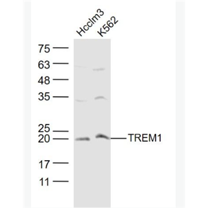 Anti-DCTREM1antibody-髓系细胞触发受体1抗体,TREM1