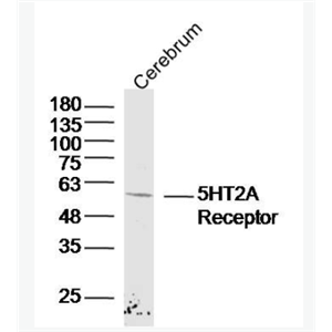 Anti-5HT2A Receptor  antibody-5-羟色胺受体2A抗体