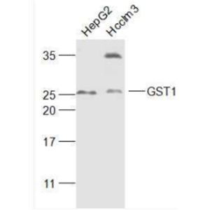 Anti-GST1 antibody-谷胱甘肽转移酶抗体,GST1