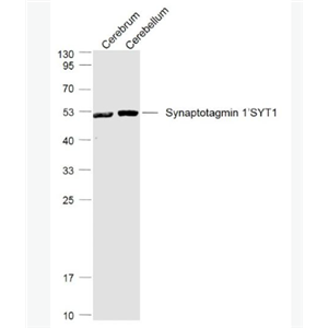 Anti-Synaptotagmin 1/SYT1 antibody-突触结合蛋白1抗体
