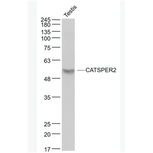 Anti-CATSPER2 antibody-阳离子通道精子相关蛋白2抗体