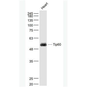 Anti-KAT5 / Tip60 antibody-TIP60抗体