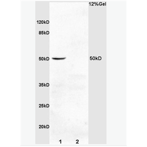 Anti-PDCD4  antibody-凋亡相关蛋白4抗体