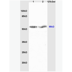 Anti-Cyp2J3 antibody-细胞色素P450Ⅱj3抗体,Cyp2J3