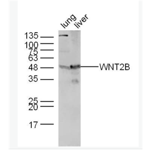 Anti-WNT2B antibody-信号通路Wnt2B抗体