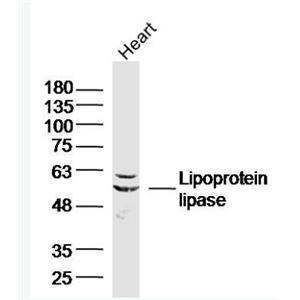 Anti-Lipoprotein lipase antibody-脂蛋白脂酶抗体