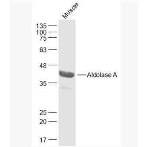 Anti-Aldolase A antibody-醛缩酶A抗体