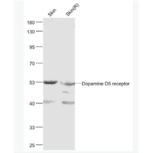 Anti-Dopamine D5 receptor antibody-多巴胺受体D5抗体,Dopamine D5 receptor