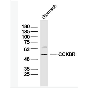 Anti-CCKBR antibody-促胃泌素受体抗体