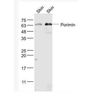 Anti-Porimin antibody-前细胞胀亡受体诱导膜损伤蛋白抗体,Porimin