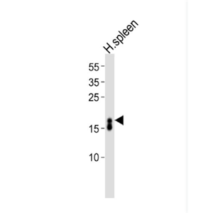 Anti-Ribonuclease 3/ECP antibody-嗜酸性粒细胞阳离子蛋白抗体