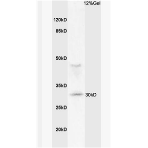 Anti-MHC Class II antibody-组织相容性复合体蛋白2（HLA-DMB）抗体