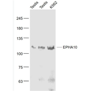Anti-EPHA10 antibody-酪氨酸蛋白激酶受体A10抗体