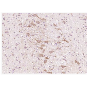 Anti-CTNND2/delta 2 Catenin antibody-δ-连环蛋白抗体,CTNND2/delta 2 Catenin