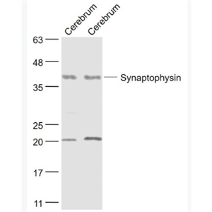 Anti-Synaptophysin antibody-突觸小泡蛋白P38抗體