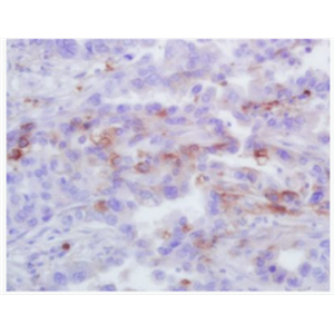 Anti-GRO Alpha antibody-黑色素瘤生长刺激活性蛋白α/GROa抗体