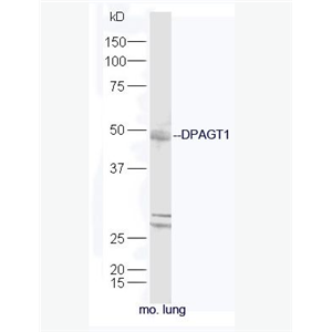 Anti-DPAGT1antibody-DPAGT1蛋白抗體,DPAGT1