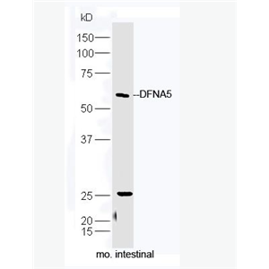 Anti-DFNA5 antibody-耳聋相关常染色体显性遗传5抗体