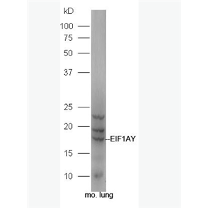 Anti-EIF1AY antibody-真核翻译起始因子1A抗体