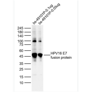Anti-HPV16 E7  antibody-人乳头瘤病毒16型E7抗体