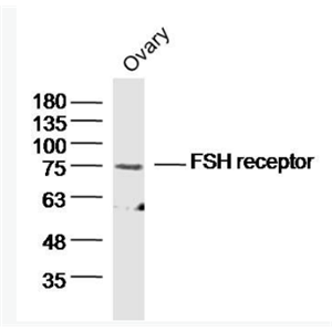 Anti-FSH receptor antibody-促卵泡刺激素受体抗体.