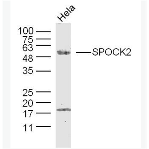 Anti-SPOCK2  antibody-睾丸蛋白聚糖2抗体,SPOCK2