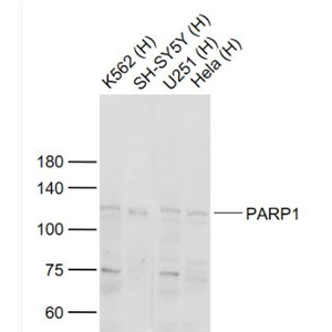 Anti-PARP1 antibody-多腺苷二磷酸多聚酶抗体/多聚ADP-核糖聚合酶1抗体,PARP1