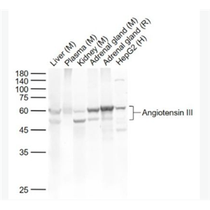 Anti-Angiotensin III antibody-血管紧张素III抗体
