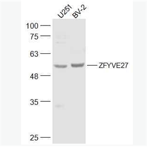 Anti-ZFYVE27 antibody-锌指FYVE结构域蛋白27抗体