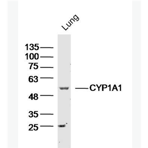 Anti-CYP1A1 antibody-细胞色素P450 1A1抗体,CYP1A1