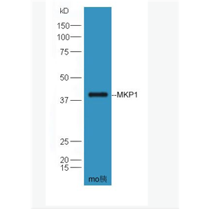 Anti-MKP1 antibody-丝裂原活化蛋白激酶磷酸酶-1抗体
