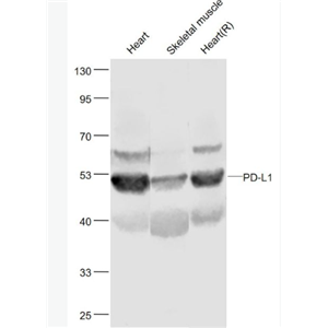 Anti-PD-L1 antibody-程序性死亡配体1（CD274）抗体