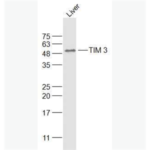 Anti-HAVCR2/TIM-3antibody-T淋巴细胞膜蛋白3（CD366）抗体,HAVCR2/TIM-3