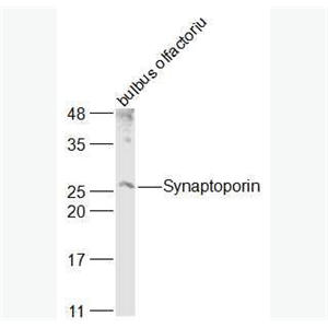 Anti-SYNPR/Synaptoporin antibody-突触囊泡蛋白抗体