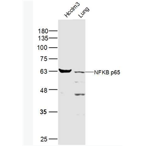 Anti-NFKB p65 antibody-细胞核因子NFKBp65抗体