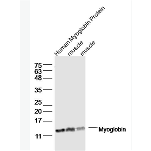 Anti-Myoglobin  antibody-肌红蛋白抗体
