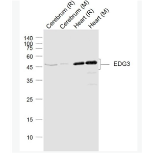 Anti-EDG3 antibody-内皮分化型G蛋白偶联受体3抗体