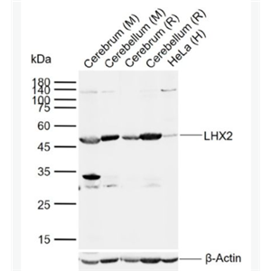 Anti-LHX2 antibody-调控胚胎干细胞分化蛋白Lhx2抗体,LHX2