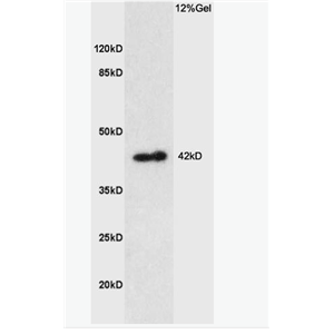 Anti-Prostaglandin E Receptor EP1  antibody-前列腺素EP1受体抗体,Prostaglandin E Receptor EP1