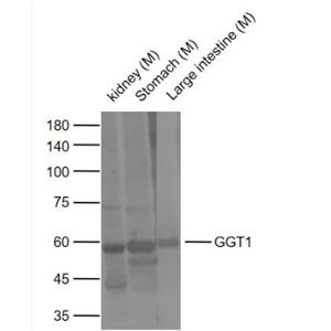 Anti-GGT1 antibody-γ谷氨酰转移酶抗体