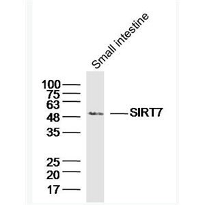 Anti-SIRT7 antibody-沉默调节样蛋白SirT7抗体