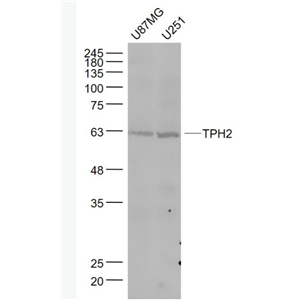 Anti-TPH2 antibody-5色氨酸羟化酶2抗体