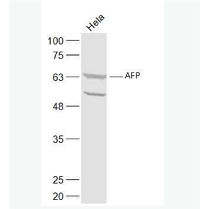 Anti-AFP antibody-甲胎蛋白抗体