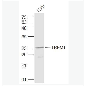 Anti-TREM1 antibody-髓系细胞触发受体1抗体