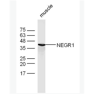Anti-NEGR1 antibody-神经生长调节蛋白1抗体