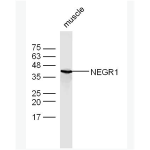 Anti-NEGR1 antibody-神经生长调节蛋白1抗体,NEGR1