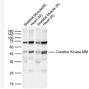 Anti-Creatine Kinase MM antibody-肌酸激酶M型抗体