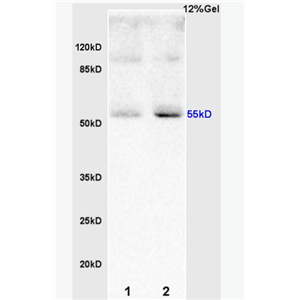 Anti-RBPJK  antibody-Notch转录调控蛋白RBPJK抗体